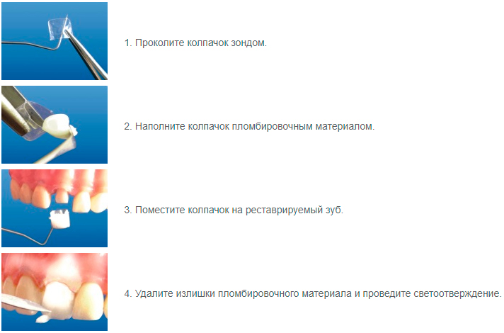 МАТРИЦЫ КОНТУРНЫЕ ЛАВСАНОВЫЕ ЗАКРЫТЫЕ
