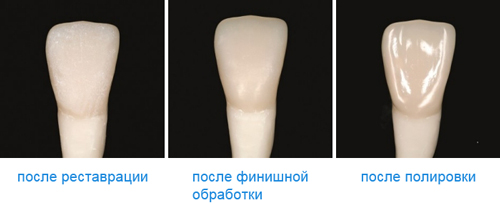 ceram.x SphereTEC Dentsply ceram.x SphereTEC Dentsply