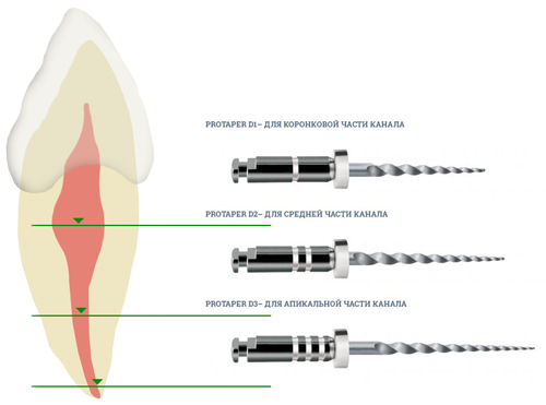 Машинные протейперы Protaper Universal Dentsply Машинные протейперы Protaper Universal Dentsply
