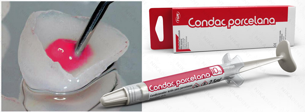 Condac porcelana гель плавиковой кислоты 10% для травления изделий из стоматологической керамики. Condac porcelana гель плавиковой кислоты 10% для травления изделий из стоматологической керамики.