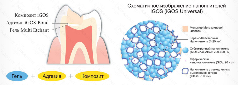 igos universal - светоотверждаемый композитный пломбировочный материал на основе керамо-кластерного наполнителя. Содержит цирконий. igos universal - светоотверждаемый композитный пломбировочный материал на основе керамо-кластерного наполнителя. Содержит цирконий.