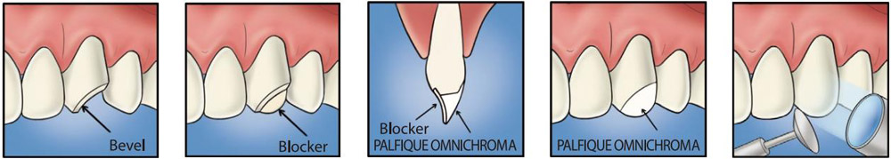 omnichroma omnichroma