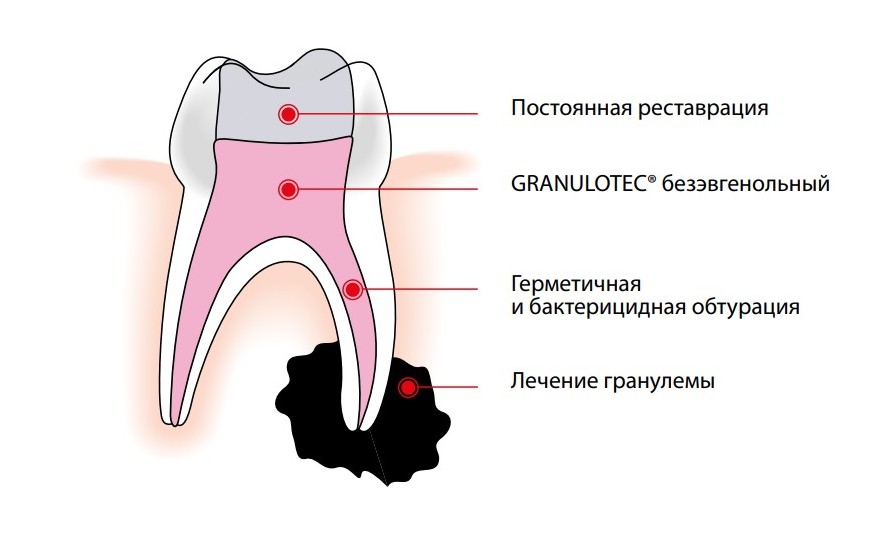 гран.jpg гран.jpg