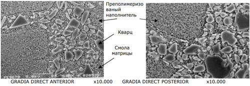GRADIA DIRECT ANTERIOR и POSTERIOR GRADIA DIRECT ANTERIOR и POSTERIOR