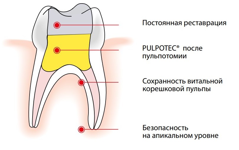 пульпотек.jpg пульпотек.jpg