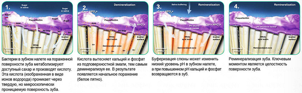 Tooth Mousse гель с био-доступными кальцием и фосфатом для реминерализации эмали и восстановления минерального баланса в полости рта Tooth Mousse гель с био-доступными кальцием и фосфатом для реминерализации эмали и восстановления минерального баланса в полости рта