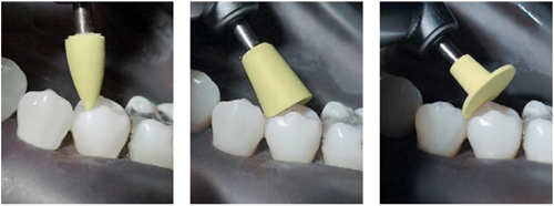 Identoflex Composite Identoflex Composite