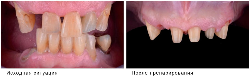 Hydrorise Hydrorise