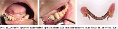 Перебазировка с использованием Tokuyama_Rebase II Перебазировка с использованием Tokuyama_Rebase II