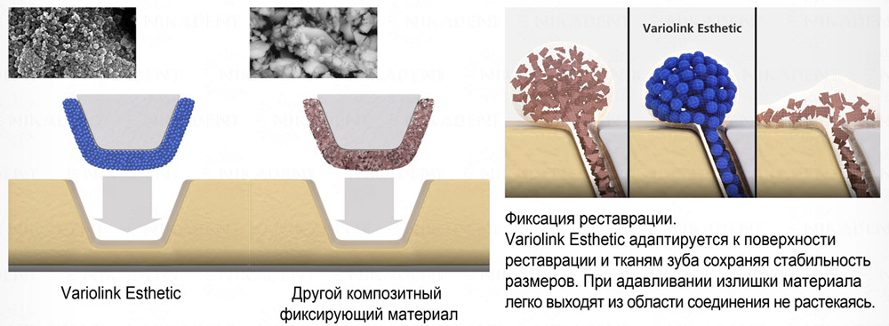Variolink Esthetic - композитный цемент для фиксации виниров, вкладок, накладок, коронок Variolink Esthetic - композитный цемент для фиксации виниров, вкладок, накладок, коронок