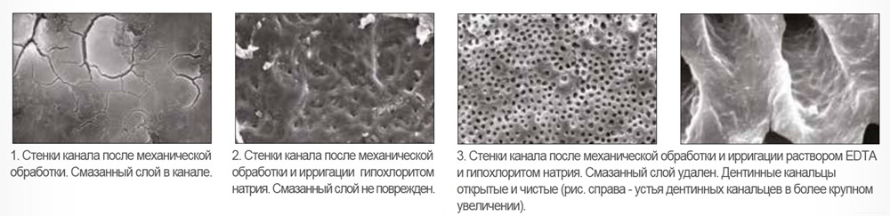 EDTA 18% - хелатный агент для кондиционирования стенок корневого канала. EDTA 18% - хелатный агент для кондиционирования стенок корневого канала.