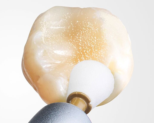 Enhance Dentsply Enhance Dentsply