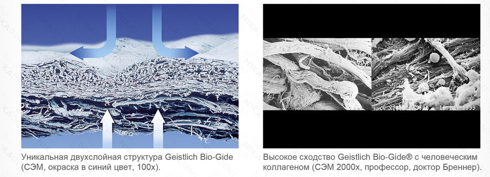 Geistlich Bio-Gide является ведущей коллагеновой мембраной для регенерации тканей полости рта Geistlich Bio-Gide является ведущей коллагеновой мембраной для регенерации тканей полости рта