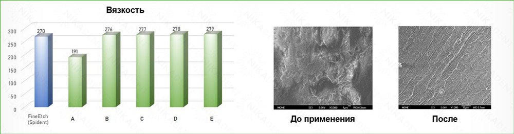 Протравливающий гель FineEtch 37% фосфорной кислоты Протравливающий гель FineEtch 37% фосфорной кислоты